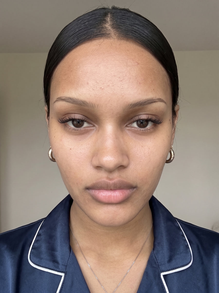 Clearer-Looking Skin — after