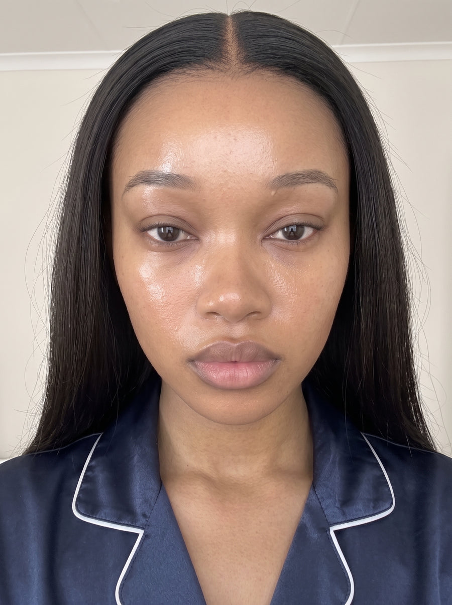 Brighter, More Even-Looking Skin — after