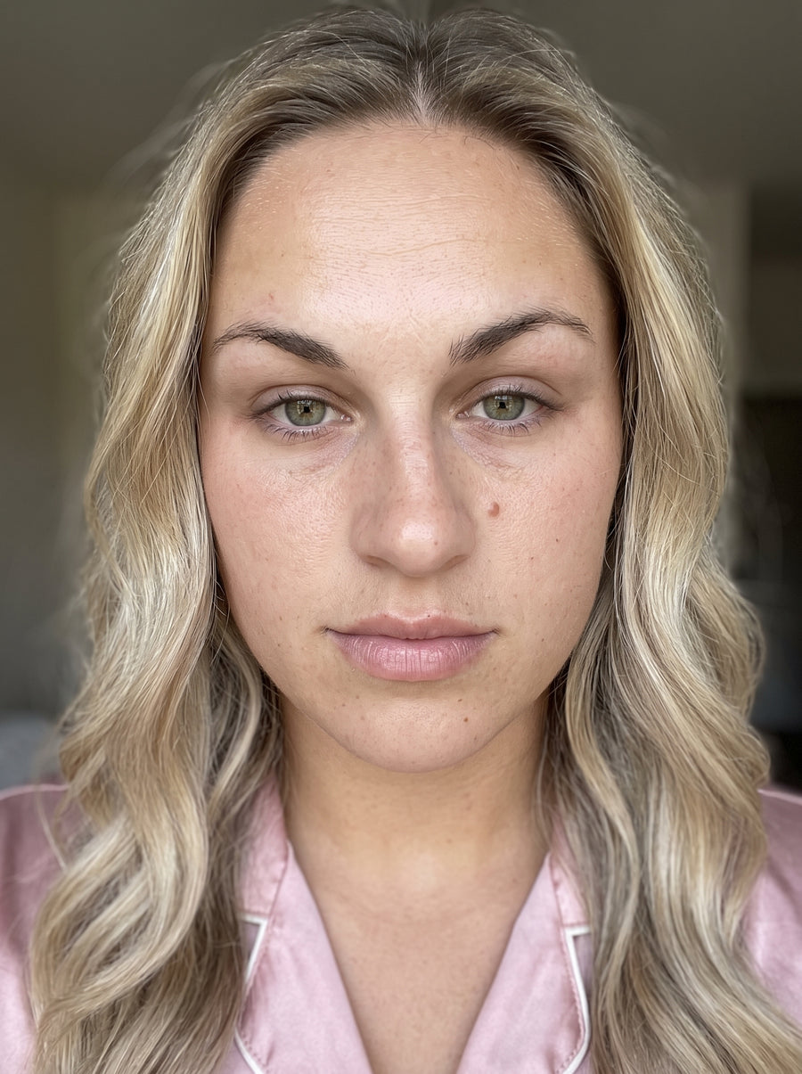 Smoother-Looking Fine Lines — before